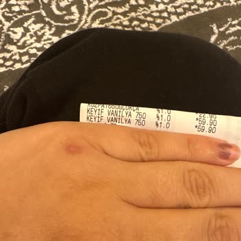 A101 Kampanyalarında Eksik İndirim Ve Yanıltıcı Fiyatlandırma