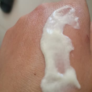 Bioderma Güneş Kremi Hayal Kırıklığı Ve Cilt Sorunları