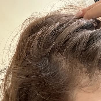 Hepsiburada OGX Biotin Collagen Şampuan İle Yaşadığım Kaşıntı Ve Kepek Kabusu