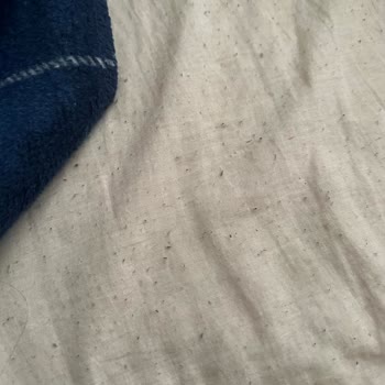 Battaniye Tüy Döküyor Çarşaflar Ve Pijamalar Mahvoldu