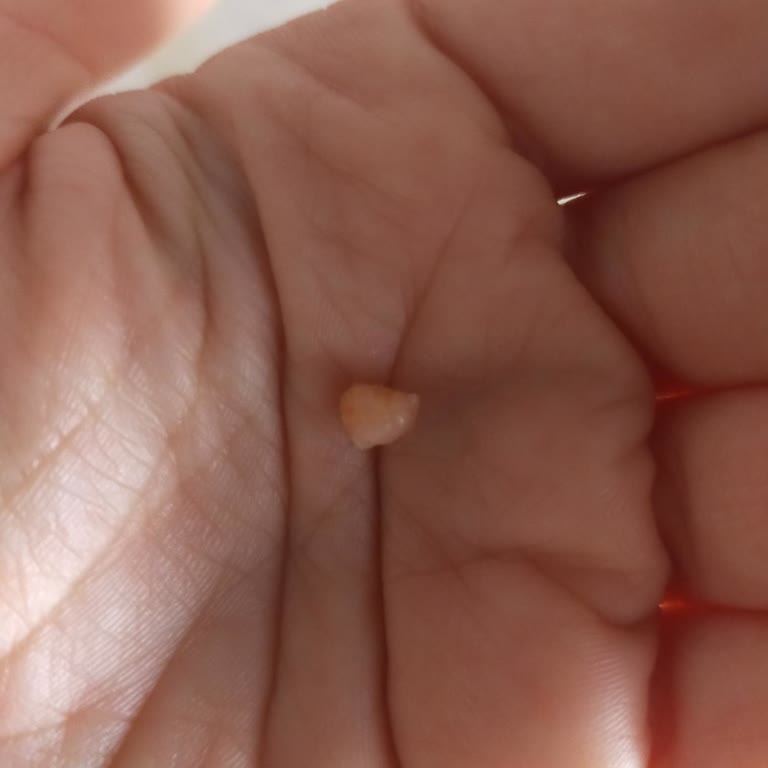 Kalitesiz Sucuk Deneyimi: Kemik Parçaları Ve Çiğnenmeyen Kısımlar