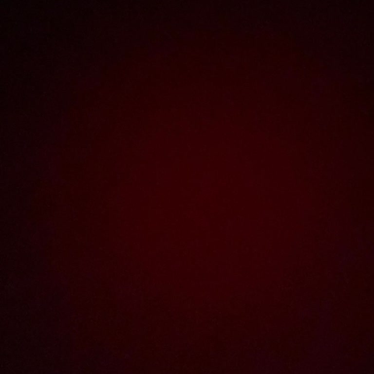 Trabzon His Hair Center'da Hayal Kırıklığı