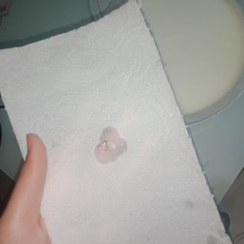 Yoğurttan Çıkan Yabancı Maddeler