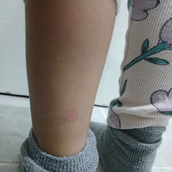 Çocuk Ayak Sağlığına Dikkat Edilmeyen Ürün