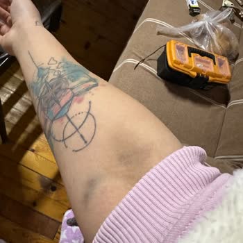 Çallı Meydan Tıp Merkezi Acil Serviste Yetersiz Hemşirelik Hizmeti