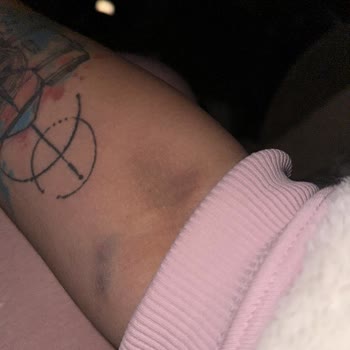 Çallı Meydan Tıp Merkezi Acil Serviste Yetersiz Hemşirelik Hizmeti