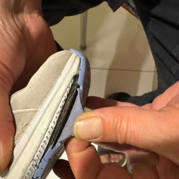 Skechers Ayakkabının Tabanında Erken Deformasyon Ve Üretim Hatası İddiası