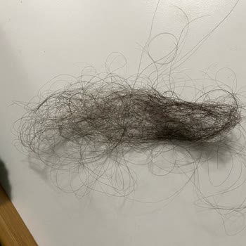 Bioxcin Kullanımında Beklenmedik Saç Dökülmesi Ve Kaşıntı Sorunu