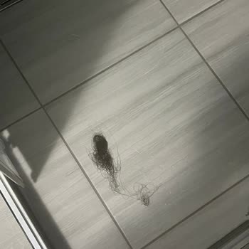 Bioxcin Kullanımında Beklenmedik Saç Dökülmesi Ve Kaşıntı Sorunu