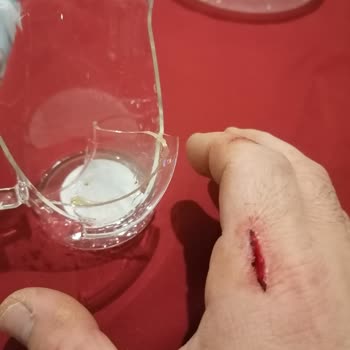 Kupa İlk Yıkamada Kırıldı Ve Yaralanmaya Sebep Oldu