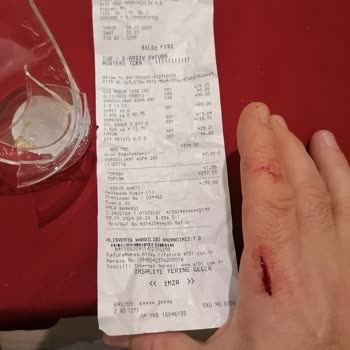 Kupa İlk Yıkamada Kırıldı Ve Yaralanmaya Sebep Oldu