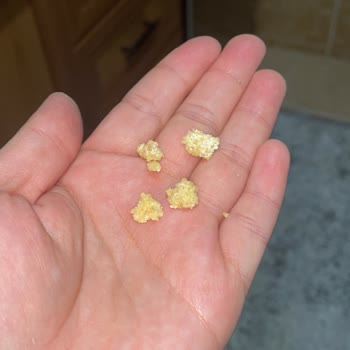 Eksik Gramaj Ve Bozuk Ürün Şikayeti