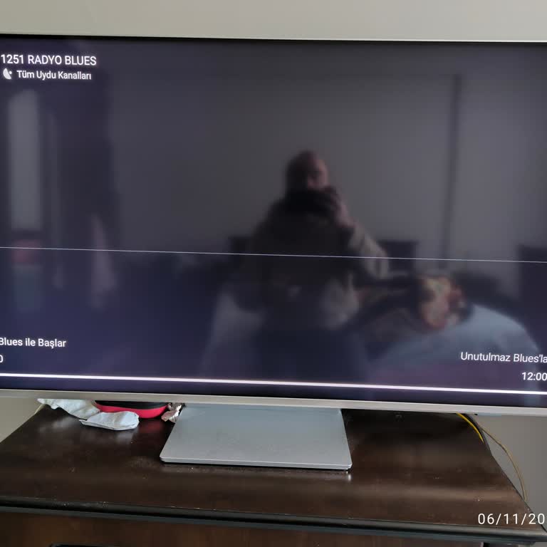 Philips TV'de Beyaz Çizgi Sorunu Ve Servis Karmaşası