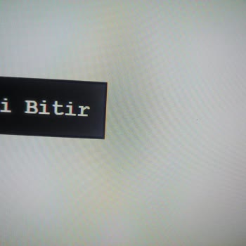 Ölü Piksel Sorunu Ve Müşteri Hizmetleri Hayal Kırıklığı