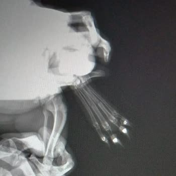 Fatih Hayvan Hastanesi Veteriner Kliniğinde İhmalkarlık Çiko'yu Kangren Yaptı!