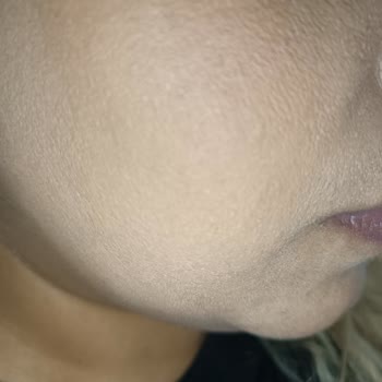 Flormar Fondöten Pul Pul Oluyor Ve Sorun Çözülmüyor