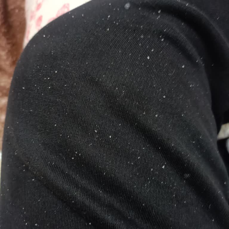 Yves Rocher Shampoo verursacht Schuppen und Haarausfall trotz Erwartungen