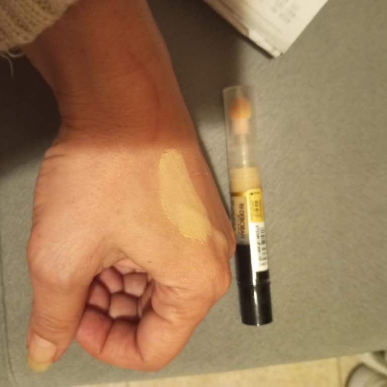 Tester Eksikliği Ve İade Sorunu