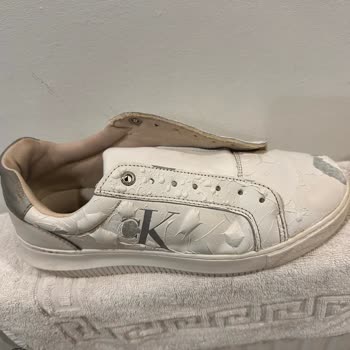 Calvin Klein Ayakkabılarında Beklenmedik Deri Kabarması