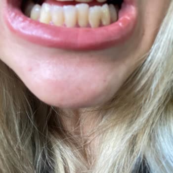 Aydın Şivet Diş Polikliniği Şikayeti