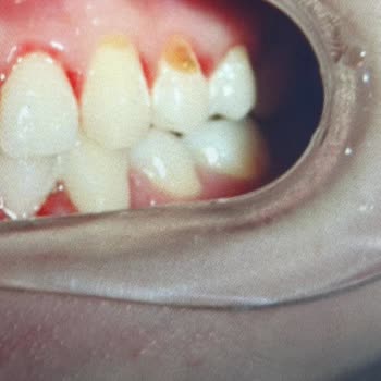 Aydın Şivet Diş Polikliniği Şikayeti