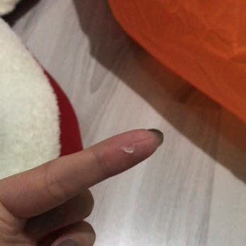 Yanlış Teşhis Ve Hatalı Tedavi İle Kedimin Sağlığı Tehlikeye Atıldı