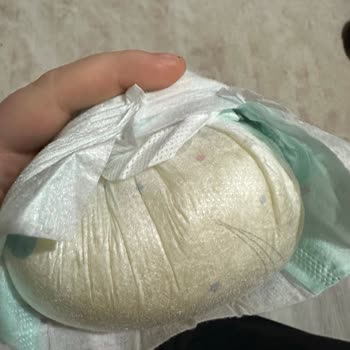 Bebek Bezi Kalitesizliği Ve Pişik Sorunu