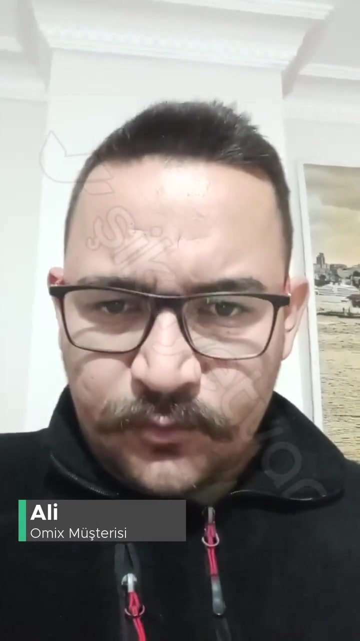 Omix Telefondan Memnun Değilim! videonun kapak resmi