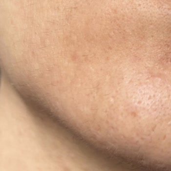 Avis Vip Eryaman Güzellik Salonu Uygulamalarında Hayal Kırıklığı Ve Sağlık Sorunları