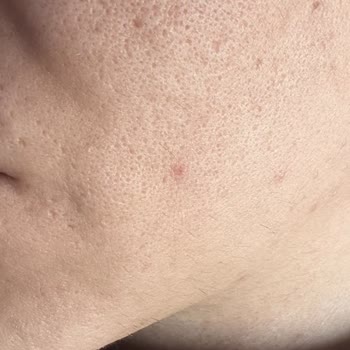 Avis Vip Eryaman Güzellik Salonu Uygulamalarında Hayal Kırıklığı Ve Sağlık Sorunları