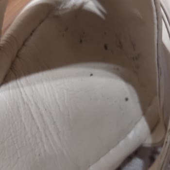 Ayakkabıdan Kaynaklanan Sağlık Sorunları Ve Mağaza İlgisizliği