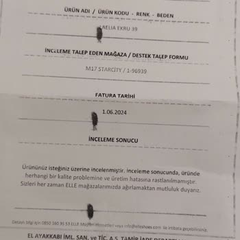 Ayakkabıdan Kaynaklanan Sağlık Sorunları Ve Mağaza İlgisizliği