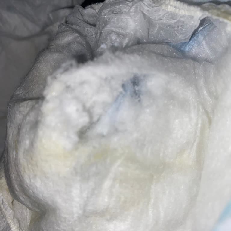 Soffio Bebek Bezinde Taş Sertliğinde Cisimler