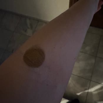 Hastanede Damar Yolu Krizi Ve Şişirilmiş Fatura Şoku