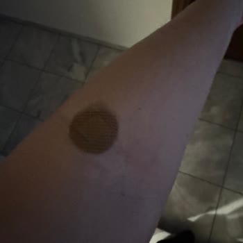 Hastanede Damar Yolu Krizi Ve Şişirilmiş Fatura Şoku