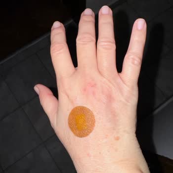 Hastanede Damar Yolu Krizi Ve Şişirilmiş Fatura Şoku