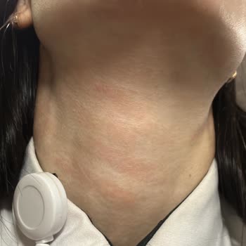 EB Estetik Life Güzellik Şikayeti