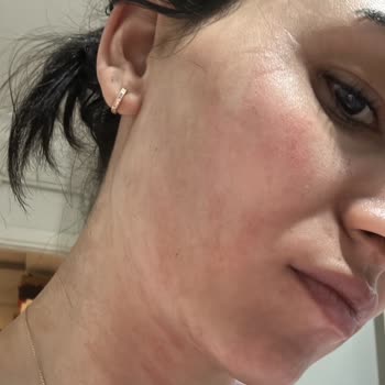 EB Estetik Life Güzellik Şikayeti