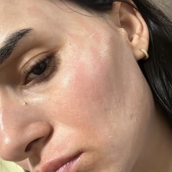 EB Estetik Life Güzellik Şikayeti