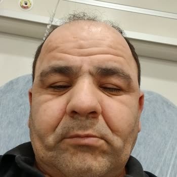 Apranax Kullanımı Sonrası Yüzde Şişlik Ve Tahriş