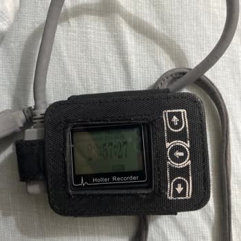 Özel Hastanede Hijyen Sorunu: Kötü Kokulu Ritim Holter Cihazı