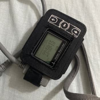 Özel Hastanede Hijyen Sorunu: Kötü Kokulu Ritim Holter Cihazı