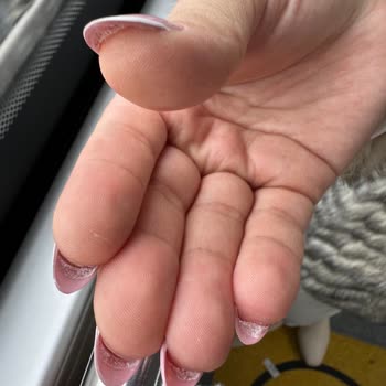 Hijyen Sorunu Ve Yanlış Uygulama Mağduriyeti