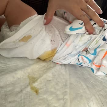 Prima Bezlerde Sızıntı Sorunu