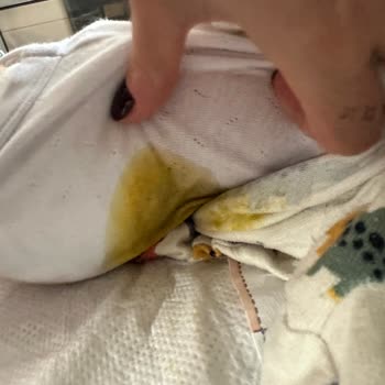 Prima Bezlerde Sızıntı Sorunu