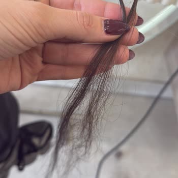 Saç Kaynağı Sorunu Ve Memnuniyetsizlik