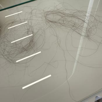 Saç Kaynağı Sorunu Ve Memnuniyetsizlik