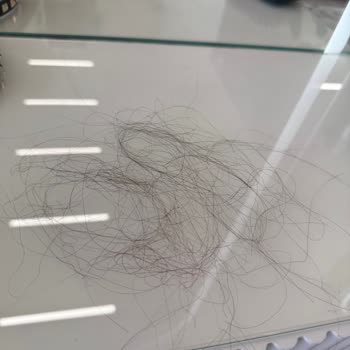 Saç Kaynağı Sorunu Ve Memnuniyetsizlik