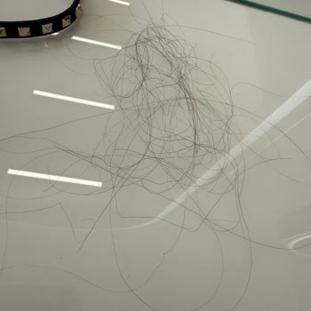 Saç Kaynağı Sorunu Ve Memnuniyetsizlik