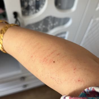 Monalisa Sağlıklı Güzellik Sincan Hijyen Ve Profesyonellik Sorunları